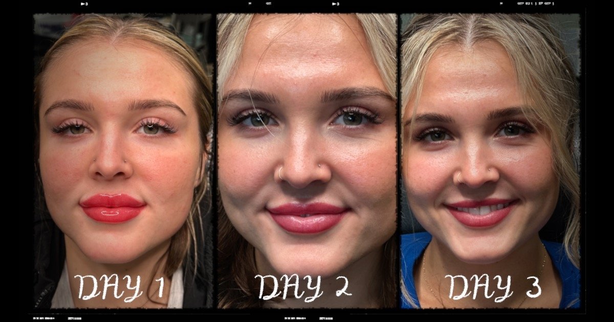 LIP BLUSH HEALING PROCESS DAY BY DAY
